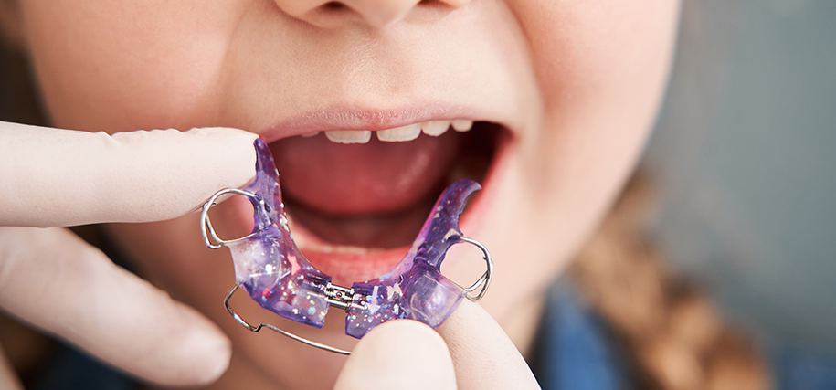 Keith Nelson Family Dentist Orthodontics Auckland Removable plate